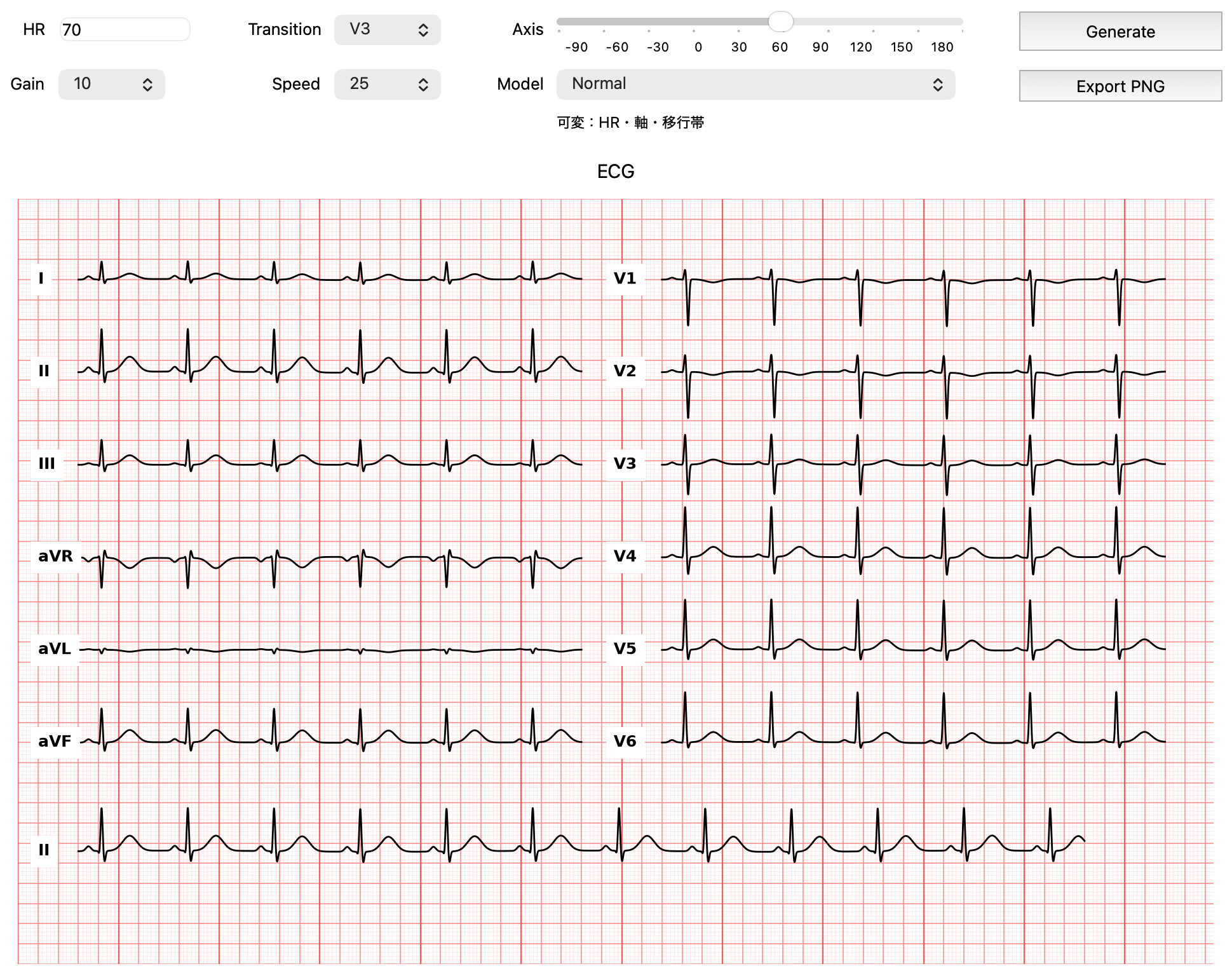 ECG Simulatorのアプリ画面