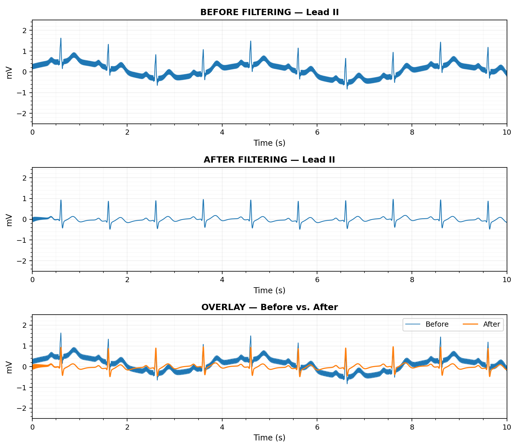 ECG Filter Simulatorのアプリ画面